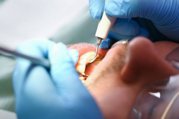 Best After-Hours Dental Trauma Care in Inman, KS