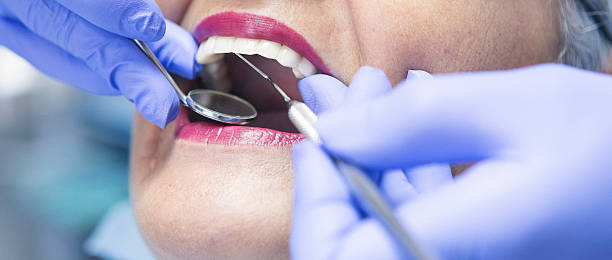 Best Emergency Dental Care for Broken or Chipped Teeth in Inman, KS